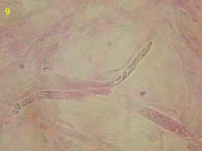 Russula acrifolia - Dermatozystide