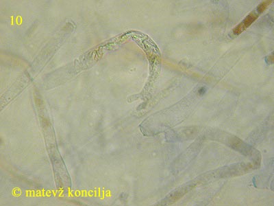 Russula acrifolia - dermatocistide
