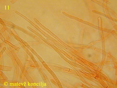 Russula acrifolia - Haare