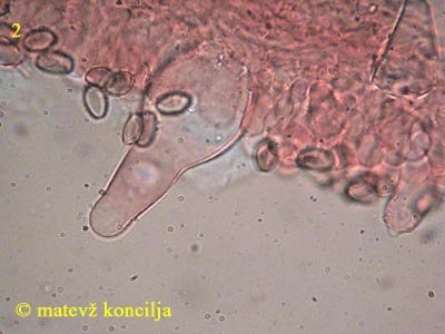 agrocybe species - Cheilozystiden