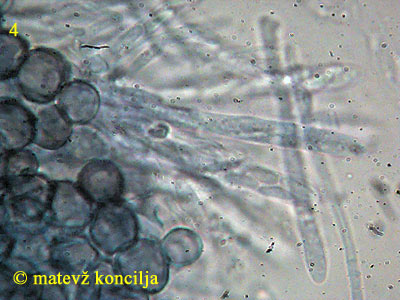 Mollisia amenticola - excipulum