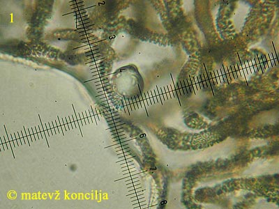 Arcyria cinerea - Spore