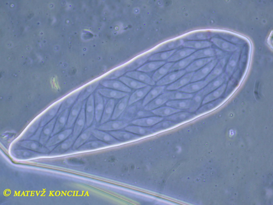 Ascozonus woolhopensis