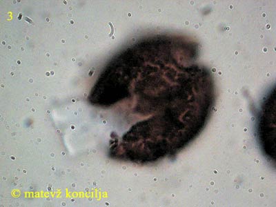 Elaphomyces asperulus - Spore