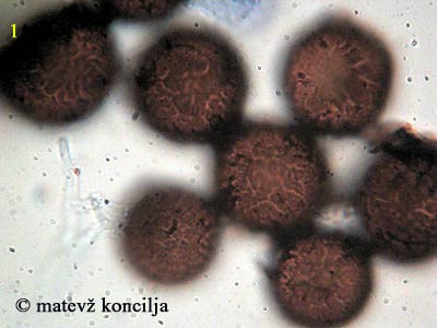 Elaphomyces asperulus - Sporen