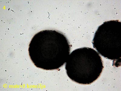 Elaphomyces asperulus - Sporen