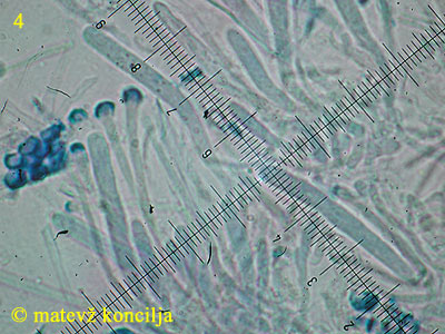 Orbilia aurantiorubra - Ascus