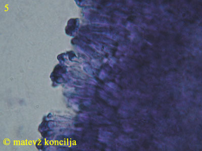 Orbilia aurantiorubra - parafize