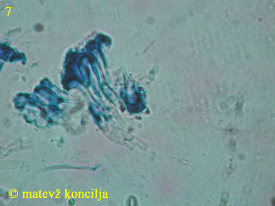 Orbilia aurantiorubra - Randzellen