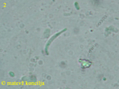 Orbilia aurantiorubra - Sporen