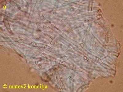 Mollisia benesuada - Subhymenium