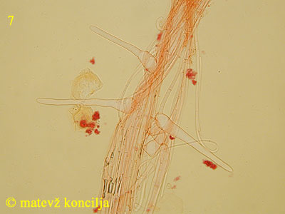 Coprinellus bisporus - kavlocistide