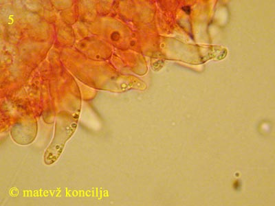 rhodocybe caelata - pseudocistide