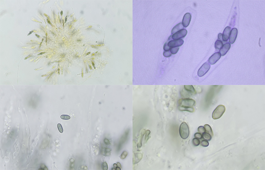 Camarops polysperma - Reichsporiger Kugelschwamm