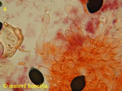 Panaeolus papilionaceus var. capitatocystis - kajlocistide