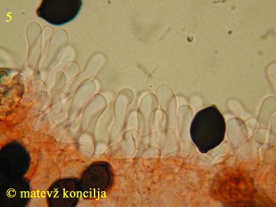 Panaeolus papilionaceus var. capitatocystis - kajlocistide
