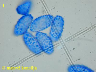 Scutellinia cejpii - Sporen