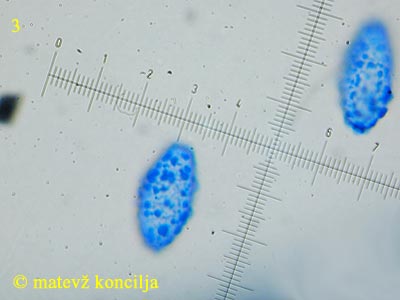 Scutellinia cejpii - Sporen
