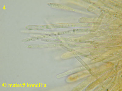 Neodasyscypha cerina - parafize