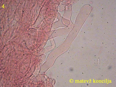 Inocybe cervicolor - Kaulozystiden