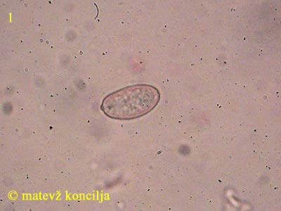 Inocybe cervicolor -Spore