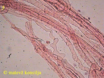 Inocybe cervicolor - Stielhyphen