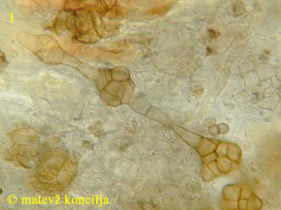 Phragmotrichum chailletii - konidiji