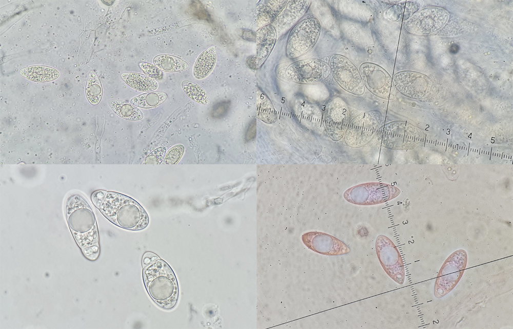 Pseudomassaria chondrospora