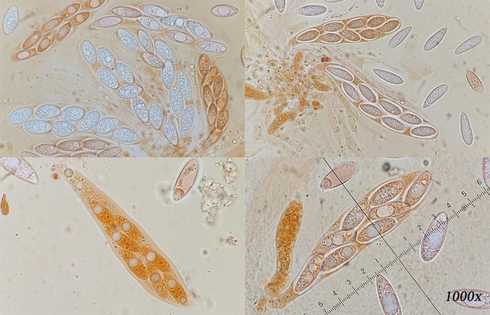 Pseudomassaria chondrospora