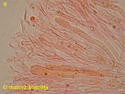 Dacrymyces chrysospermus - Basidiolen/Hyphidien