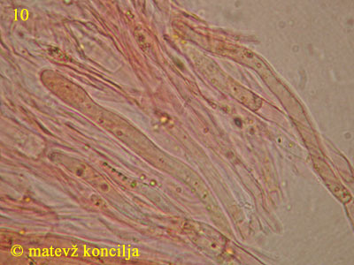 Dacrymyces chrysospermus - Basidiolen/Hyphidien