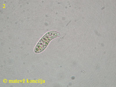 Dacrymyces chrysospermus - Sporen