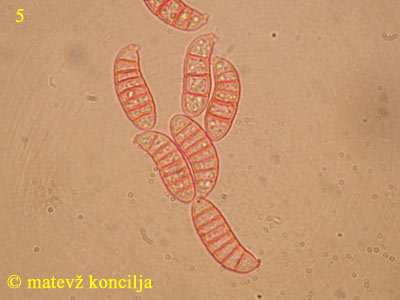 Dacrymyces chrysospermus - Sporen
