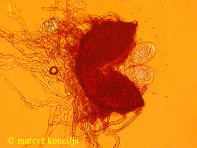 Erysiphe cichoracearum - Chasmothecium
