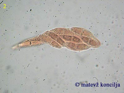 nectria cinnabarina - Ascus