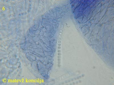Trichoderma citrinum - Excipulum