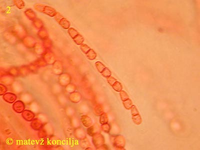 Hypocrea citrina - Sporen