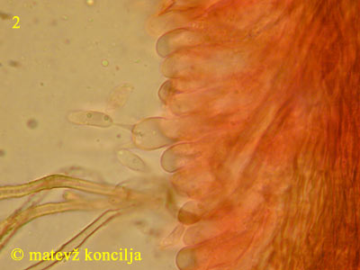 Merismodes fasciculata - Basidie