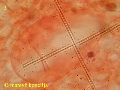 Coprinopsis cinerea - plevrocistida