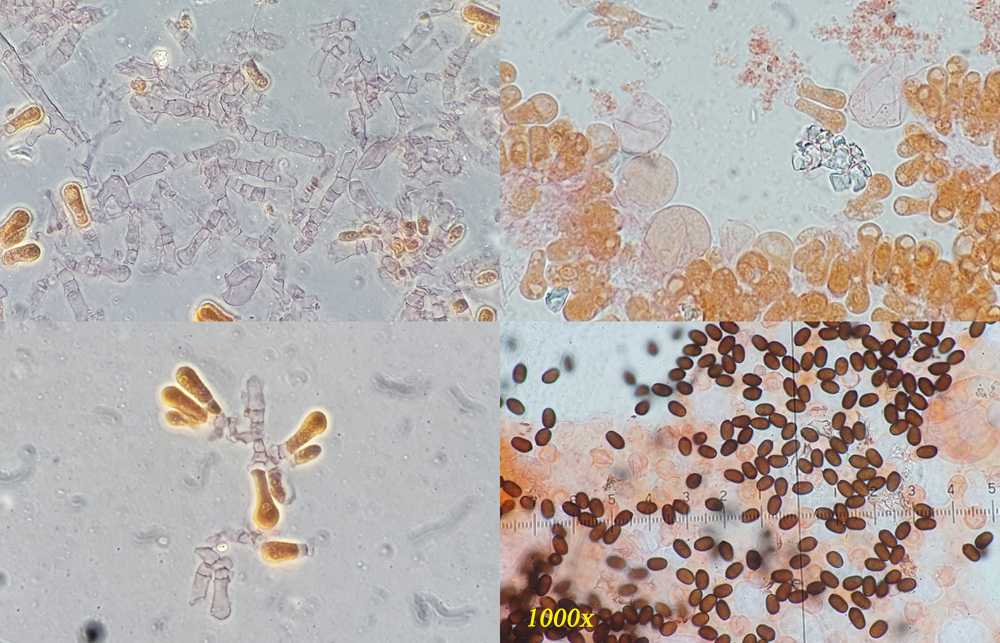 Coprinopsis filamentifera