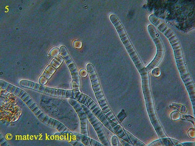 Coremiella cubispora