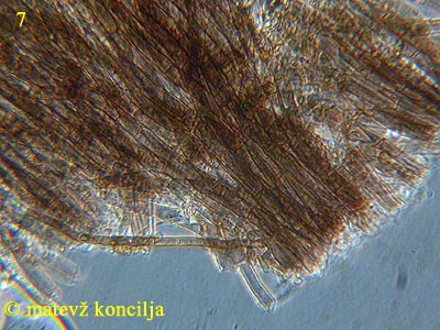 Coremiella cubispora
