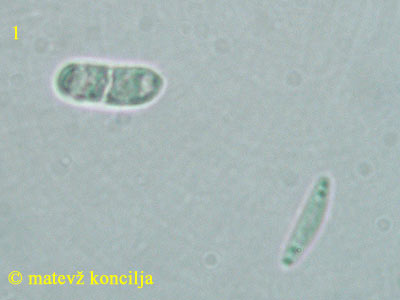 Lasiobelonium variegatum - askospore