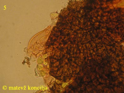 Phyllactinia guttata - cleistothecium