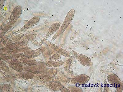 nectria coryli - aski z askokonidiji
