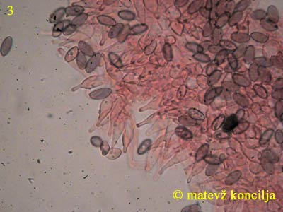 psilocybe cyanescens - pleurocistide