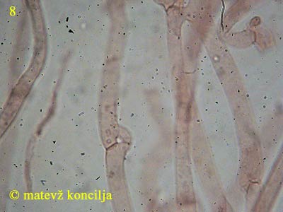 Psilocybe cyanescens - Hutdeckschicht