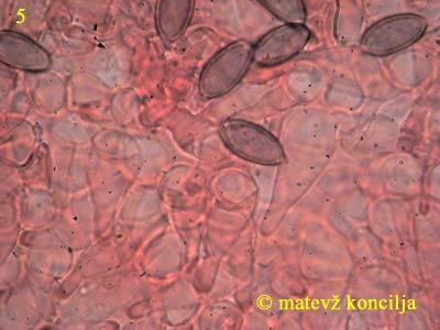 psilocybe cyanescens - pleurocistide