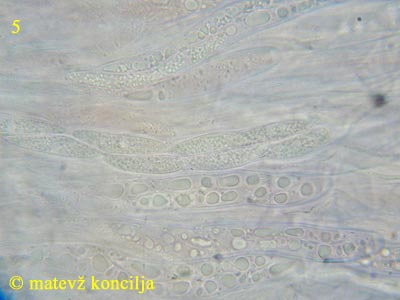 Ascocoryne cylichnium - Asci