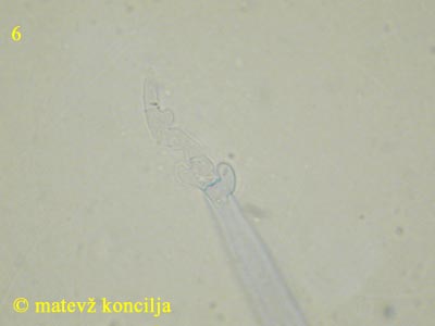 Ascocoryne cylichnium - Ascus-Basis